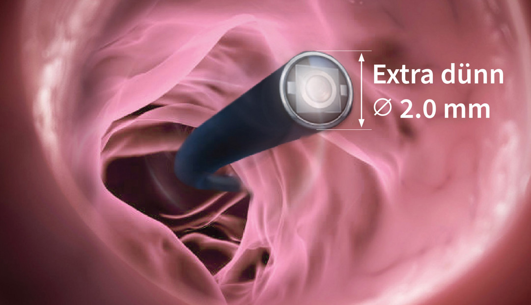 Flexible digitale Rhino-Laryngoskope EF-Serie Flexible digitale Rhino-Laryngoskope EF-Serie