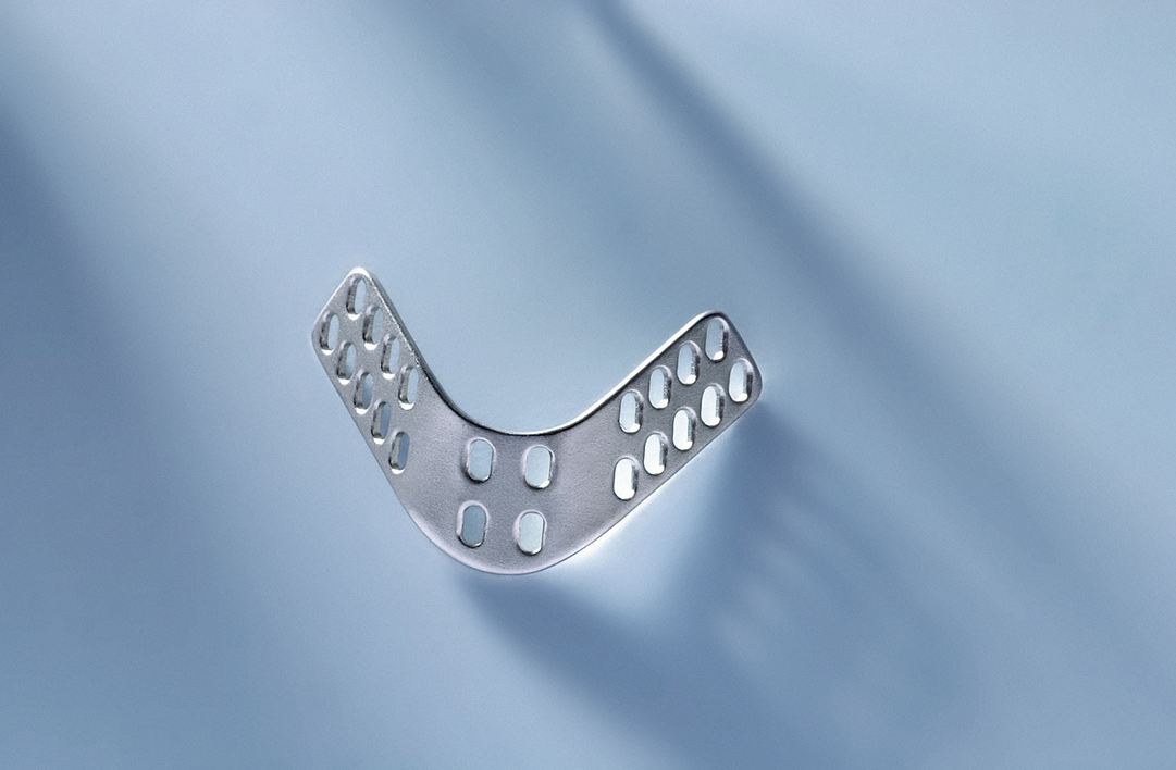 Breathe Implant àWengen — Titanimplantat für eine stabile Nasenatmung Breathe Implant àWengen — Titanimplantat für eine stabile Nasenatmung