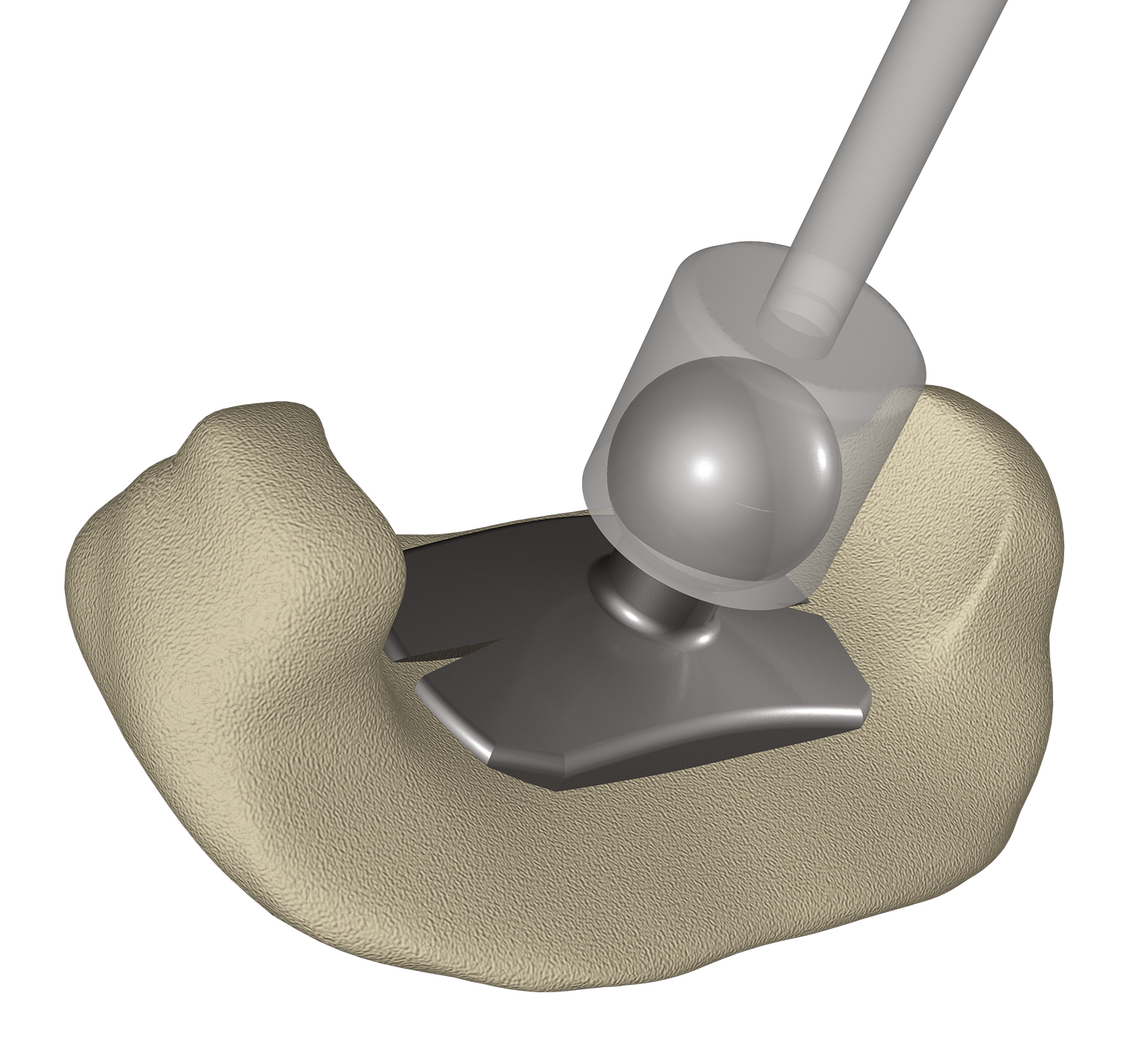 OMEGA CONNECTOR auf Fußplatte OMEGA CONNECTOR auf Fußplatte