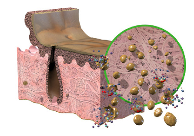 2. Osmotische Behandlung 2. Osmotische Behandlung