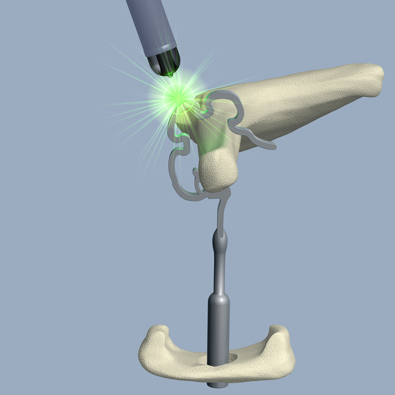 Der zweite Schuss erfolgt auf die mittlere ThermoAktiv-Zone. Der zweite Schuss erfolgt auf die mittlere ThermoAktiv-Zone.